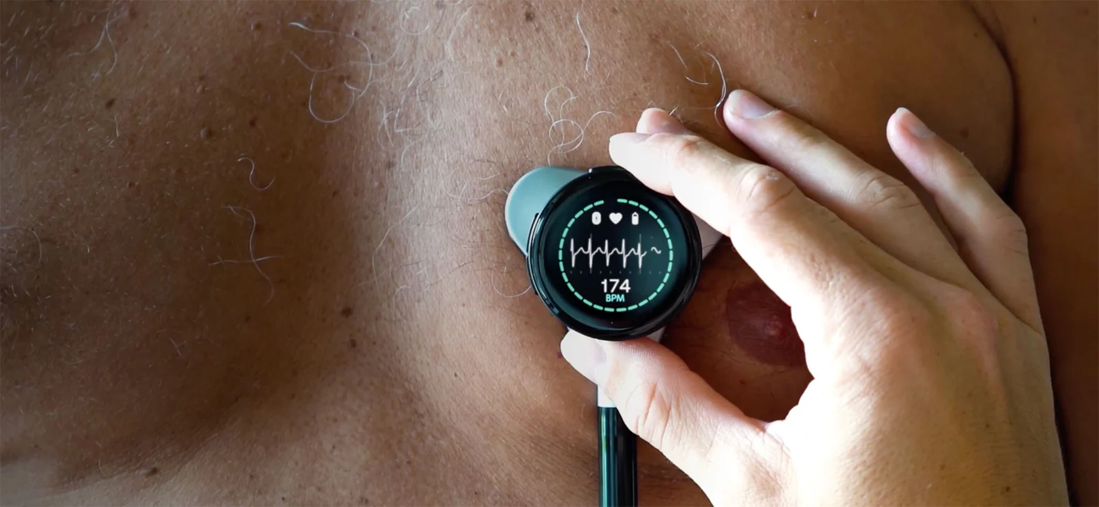 Heart Health, Reimagined Digitally